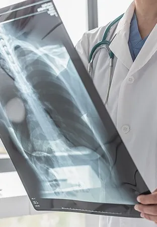 Asbestos and Mesothelioma - illustration