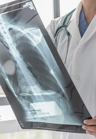 Asbestos and Mesothelioma - illustration