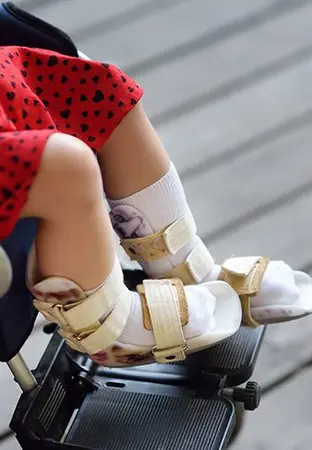 Birth Injuries & Cerebral Palsy - illustration