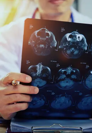 Cancer Misdiagnosis - illustration