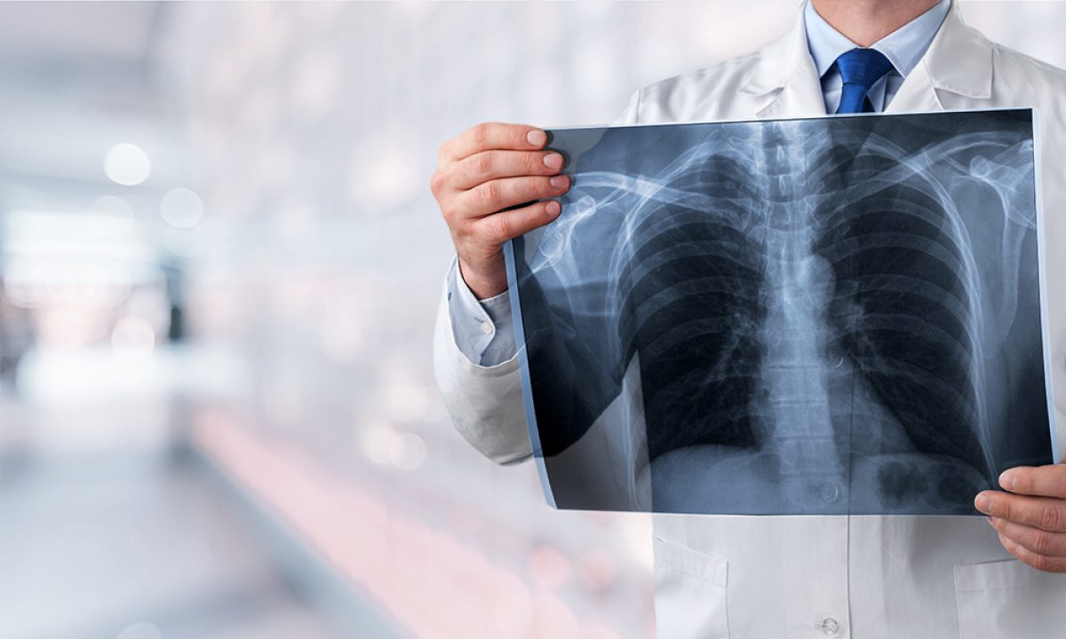best mesothelioma lawyer in michigan