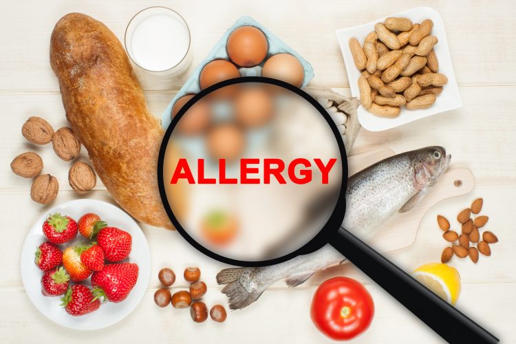 Are Restaurants Liable For Neglecting Food Allergies?