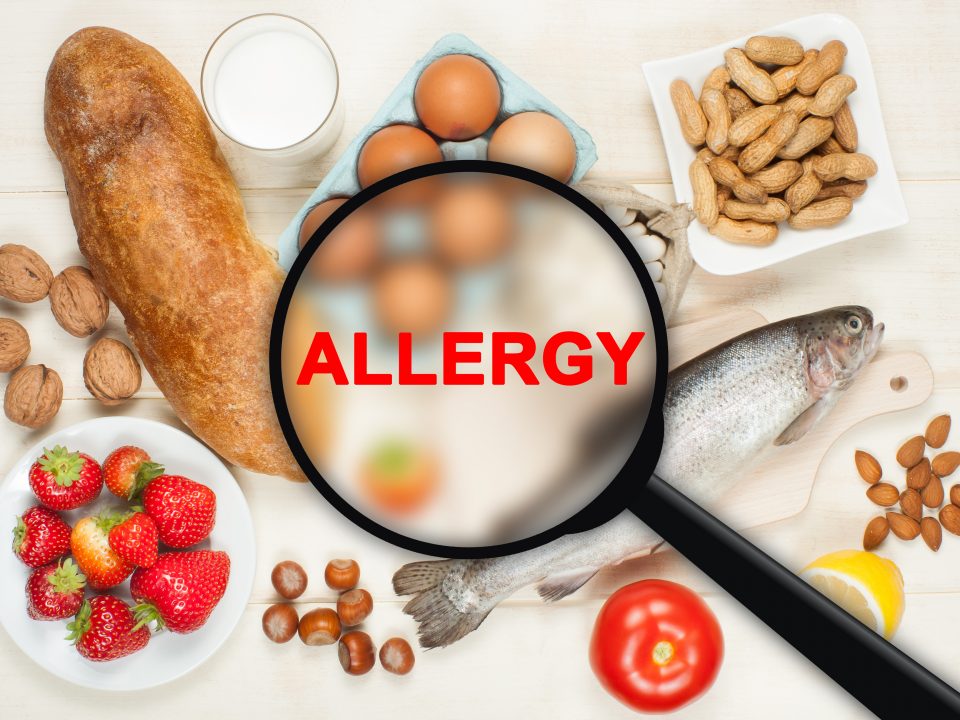 picture of various foods surrounding the word allergy in the middle being shown through a magnifying glass